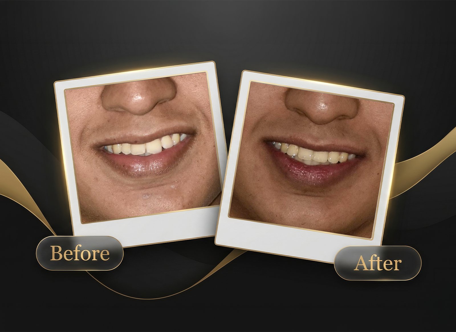 Before & After Case 2
