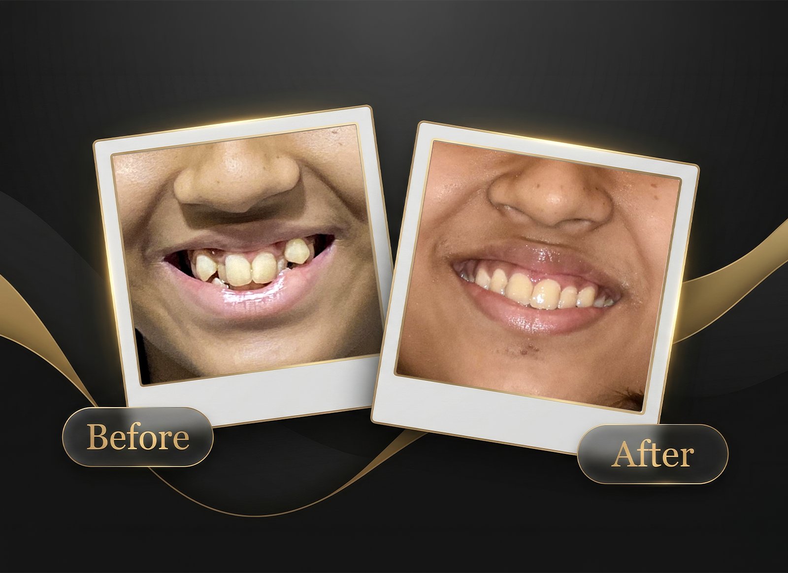 Before & After Case 3