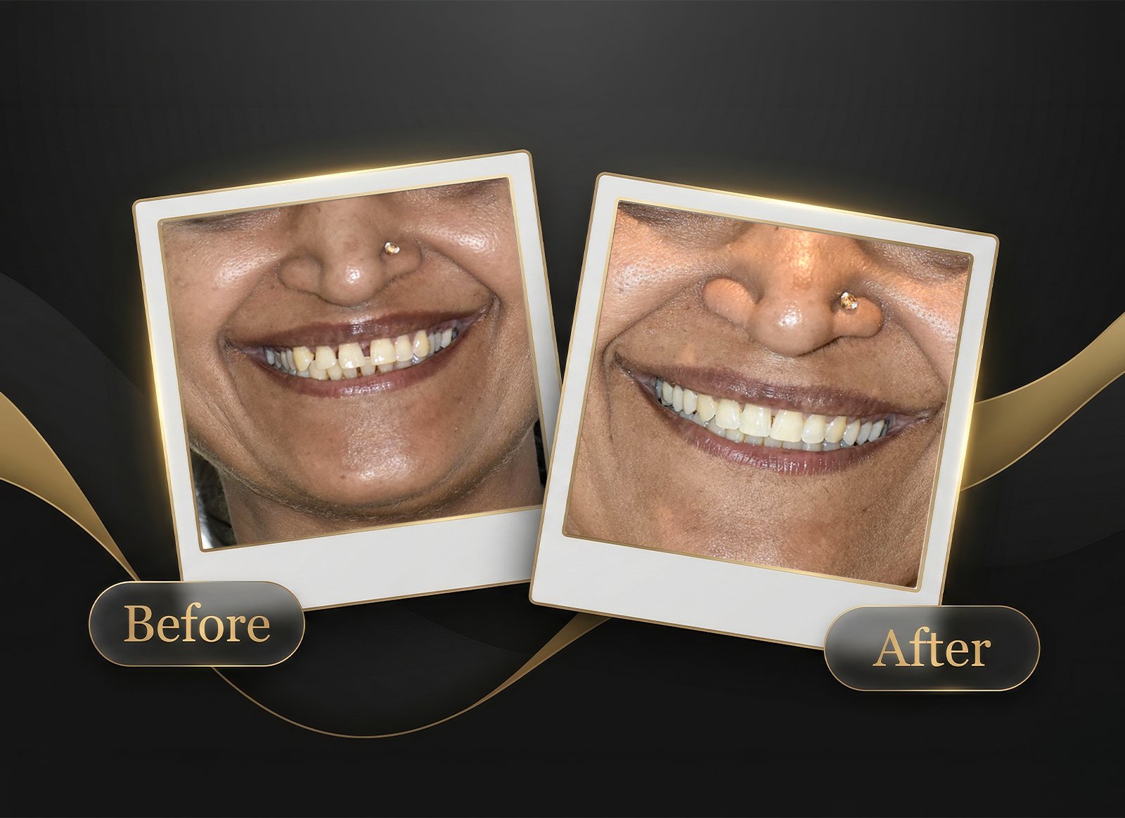 Before & After Case 4