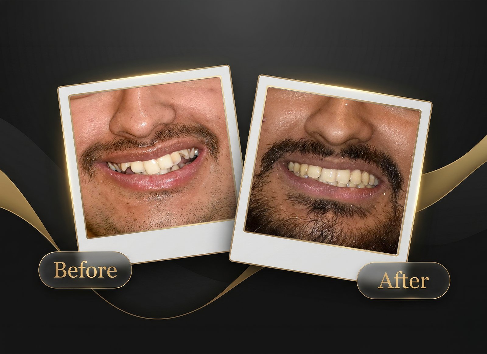 Before & After Case 5