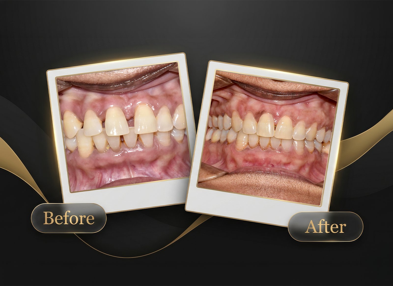 Before & After Case 6