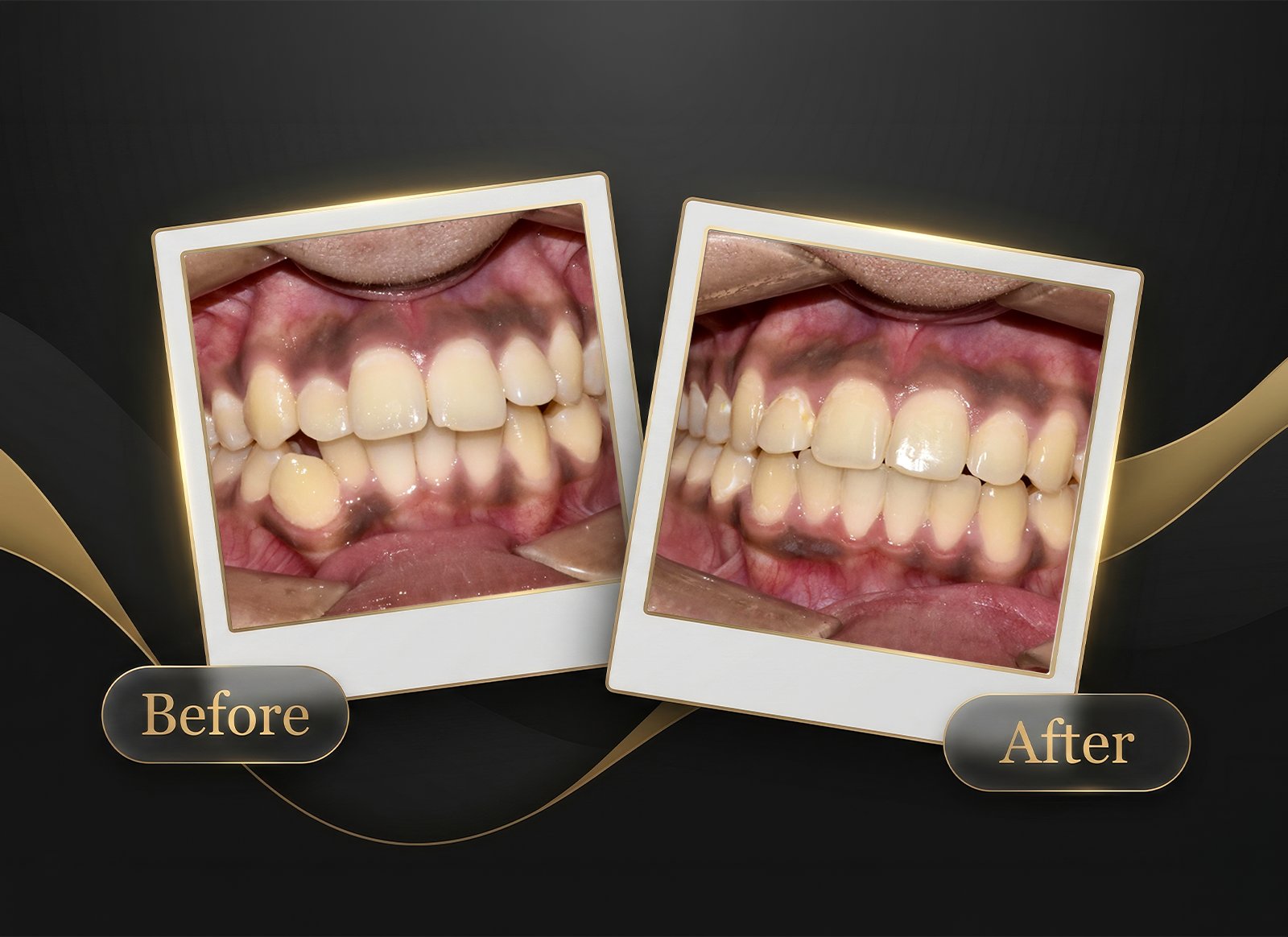 Before & After Case 7